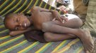 Somalia: Hambruna de 2011 causó 258 mil muertes