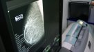Suprema ordenó al Minsal entregar droga para paciente con cáncer de mama