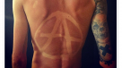Tatuajes solares: la peligrosa moda que puede provocar cáncer