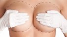 Holanda financiará los implantes mamarios para transexuales