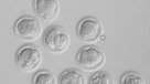 Científicos estadounidenses lograron modificación genética de embriones humanos