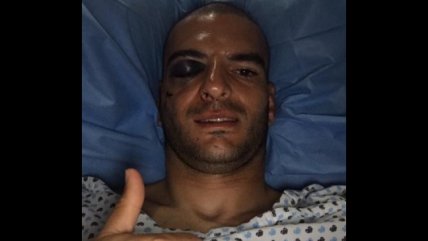 Portero uruguayo estuvo cerca de perder un ojo en el fútbol mexicano