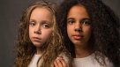 Las gemelas que sorprenden al mundo: Una es blanca y la otra negra