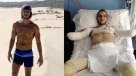 La historia del italiano al que amputaron los brazos y piernas tras diagnóstico erróneo
