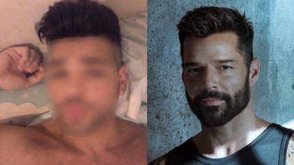  Hombre se hizo 30 cirugías para ser como Ricky Martin  