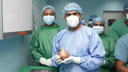   Del tamaño de un pomelo: Médicos extirpan el cálculo renal más grande y pesado del mundo 