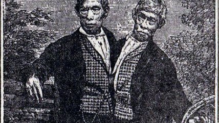 Madre y siamesas requerirán un apoyo 