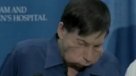Segundo trasplantado de cara en EE.UU. se presentó ante la prensa
