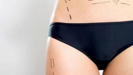 Doctor Valdés explicó las complicaciones al usar el polimetilmetacrilato