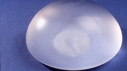 Eduardo Villalón indicó que prótesis mamarias marca PIP deben ser retiradas