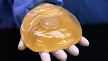   Cirujano solicitó no apresurarse en retirar implantes de silicona con problemas de fábrica 