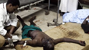 Doble atentado dejó en Uganda 64 muertos entre espectadores de la final del Mundial