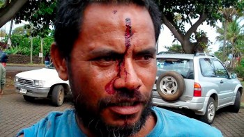 Grupo rapa nui entregó lista de heridos tras desalojo