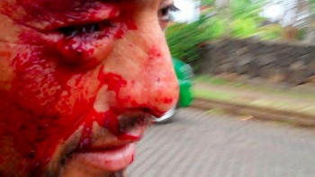 AI expresó preocupación por violaciones de derechos humanos en Isla de Pascua