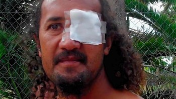 Pascuenses presentaron denuncia ante Fiscalía Militar contra Carabineros