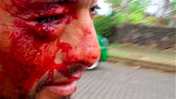 Clan Hito: Organizaciones internacionales se preocupan más por nosotros que el Gobierno