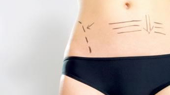   Cirujanos plásticos: La mujer se arregla para disfrutarse ella misma 