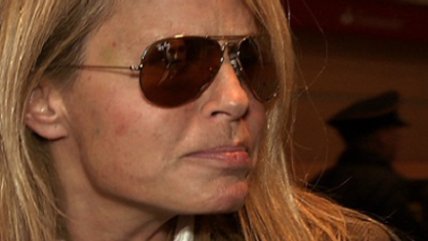 Especialista explicó riesgos de los rellenos permanentes en las cirugías estéticas