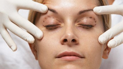 Cirujano plástico llamó a 