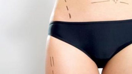 Conozca los cuidados para las cirugías plásticas pretemporada veraniega