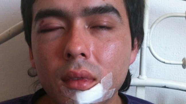 Denuncian ataque homofóbico contra joven valdiviano