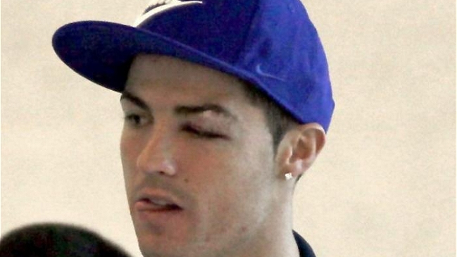 Defensa de Levante llamó a Cristiano Ronaldo para preguntarle por su estado