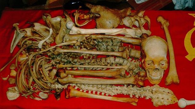 Empezó juicio contra mujer por sexo con esqueletos en Suecia