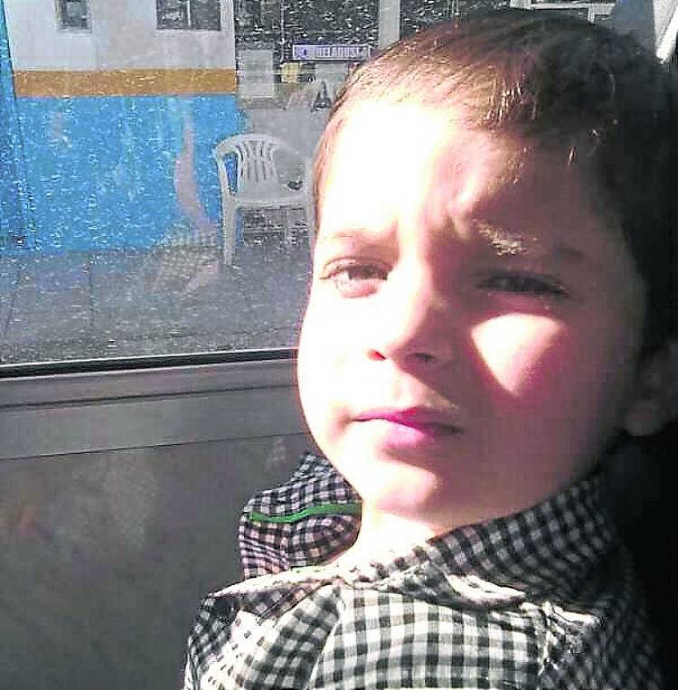 Cirujanos reconstruyeron rostro de niño atacado por pitbull en Argentina