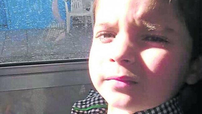 Cirujanos reconstruyeron rostro de niño atacado por pitbull en Argentina