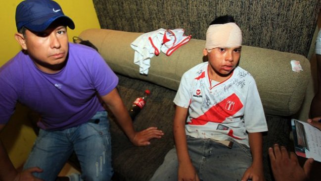 Prensa peruana denunció que hinchas chilenos agredieron a mujeres y niños