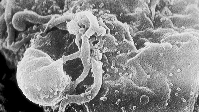 Médicos aseguran haber curado por primera vez a un bebé con VIH