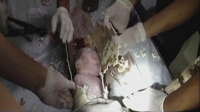 China: Salió del hospital el bebé rescatado de una tubería