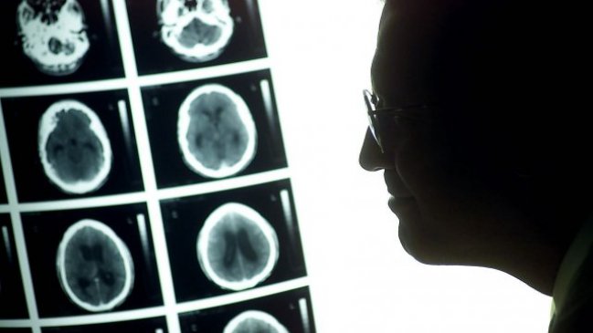 Estudio: Nueva terapia contra tipo de cáncer cerebral permite vivir más y mejor