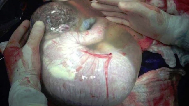 Impacto causa en redes sociales foto del 