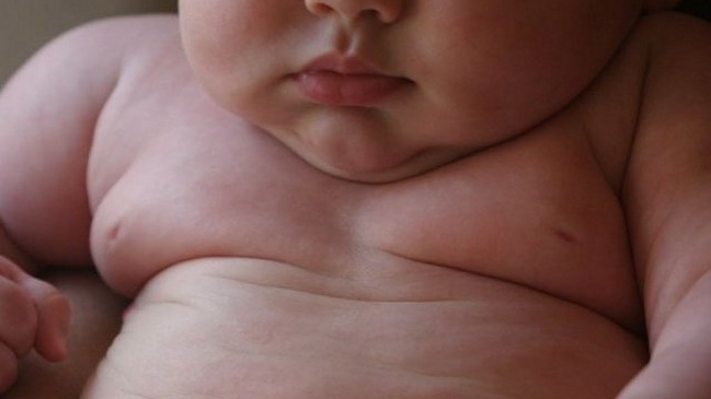 Experto y obesidad: Estamos frente a una epidemia muy difícil de combatir