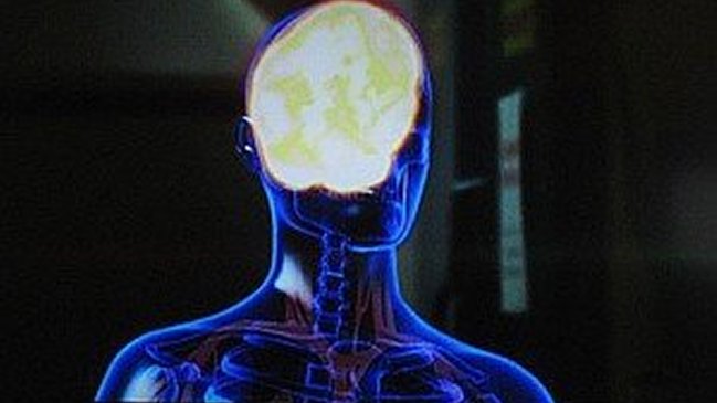 Científicos establecieron relación entre narcisismo y anomalía cerebral