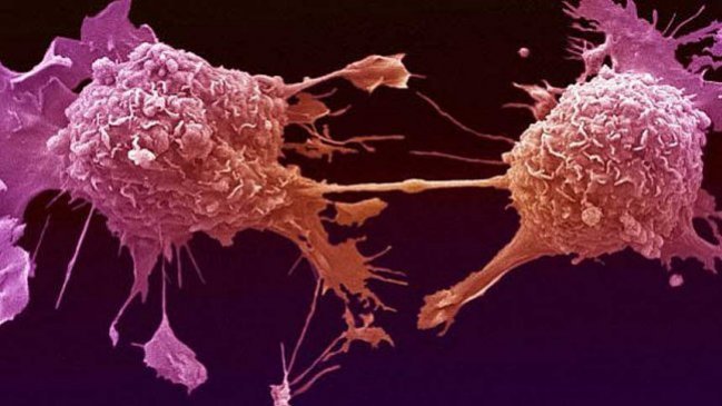 Descubren 21 pistas sobre el origen del cáncer