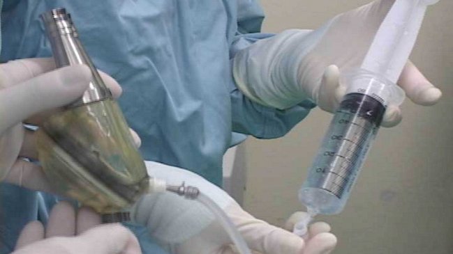 Anciano fue operado tras insertarse tenedor en el pene por 