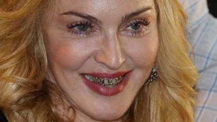   Madonna se sumó al boom de los dientes de oro 