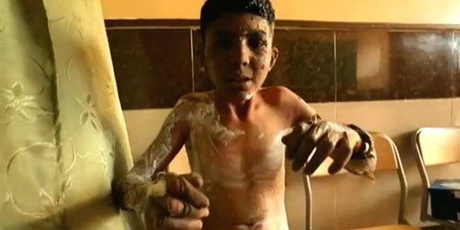 Denuncian presunto uso de napalm contra escuela en Siria