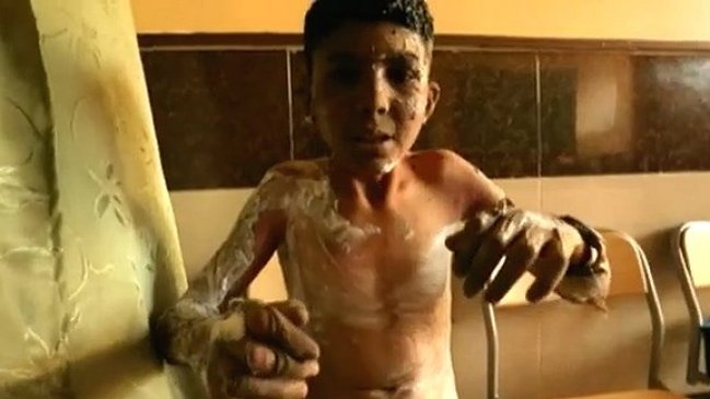 Denuncian presunto uso de napalm contra escuela en Siria