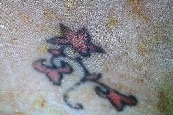 Tatuaje será clave para identificar a mujer mutilada en Santiago