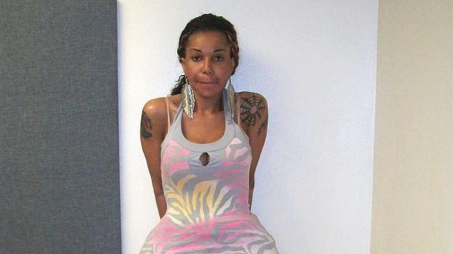 Falsa cirujana pasará un año en la cárcel por inyectar pegamento a pacientes