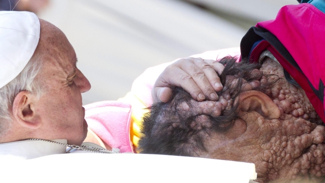 El papa abrazó y bendijo a un hombre gravemente enfermo
