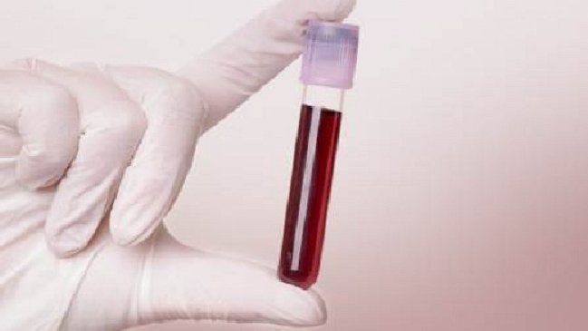 Una muestra de sangre podría sustituir a la biopsia para detectar el cáncer