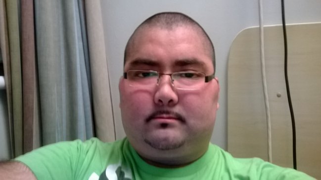 Isapres: Sergio Neira tampoco hubiese tenido cobertura en Fonasa