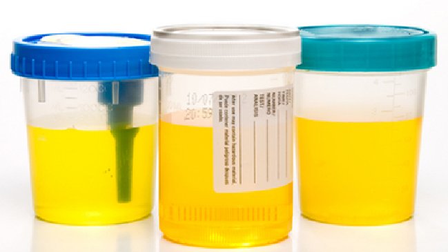 Los beneficios de reciclar la orina