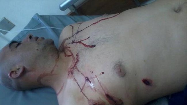 Testigos denuncian que carabinero hirió a un pescador en protestas de Lebu