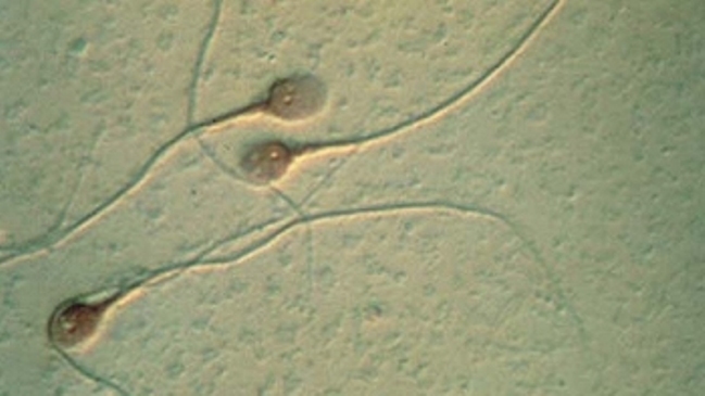 Estudio dice que químicos presentes en alimentos afectan capacidad de espermios