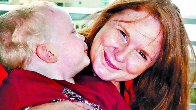 Mujer halló a su padre por Facebook tras 18 años para donación de médula